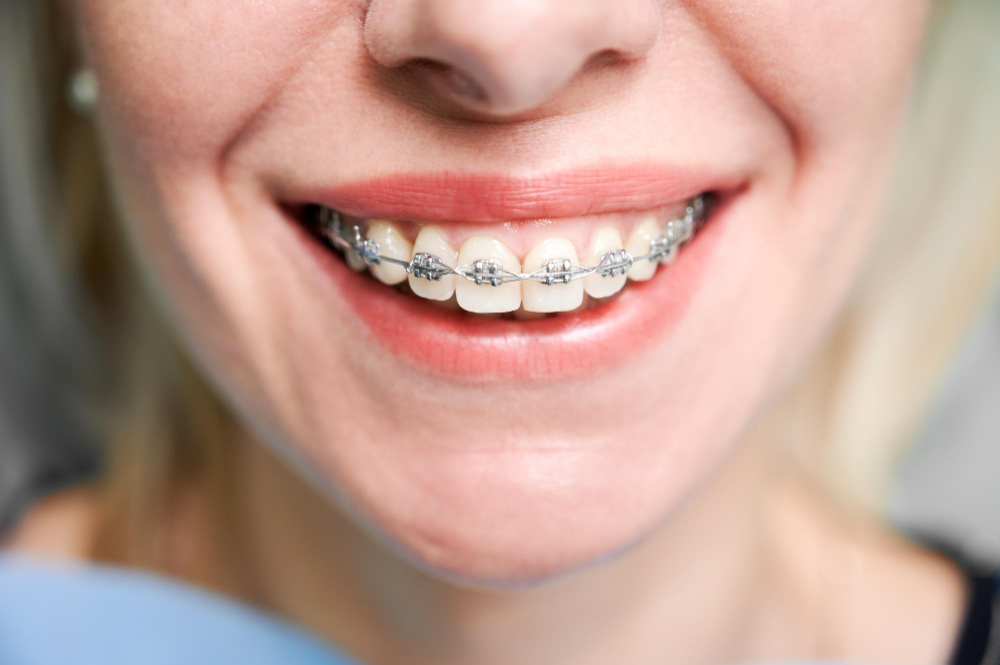 Orthodontic Services
